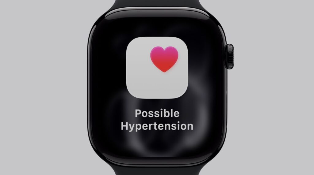 Otro palo para los productos de Apple en España: los Apple Watch no tendrán una de las funciones estrella