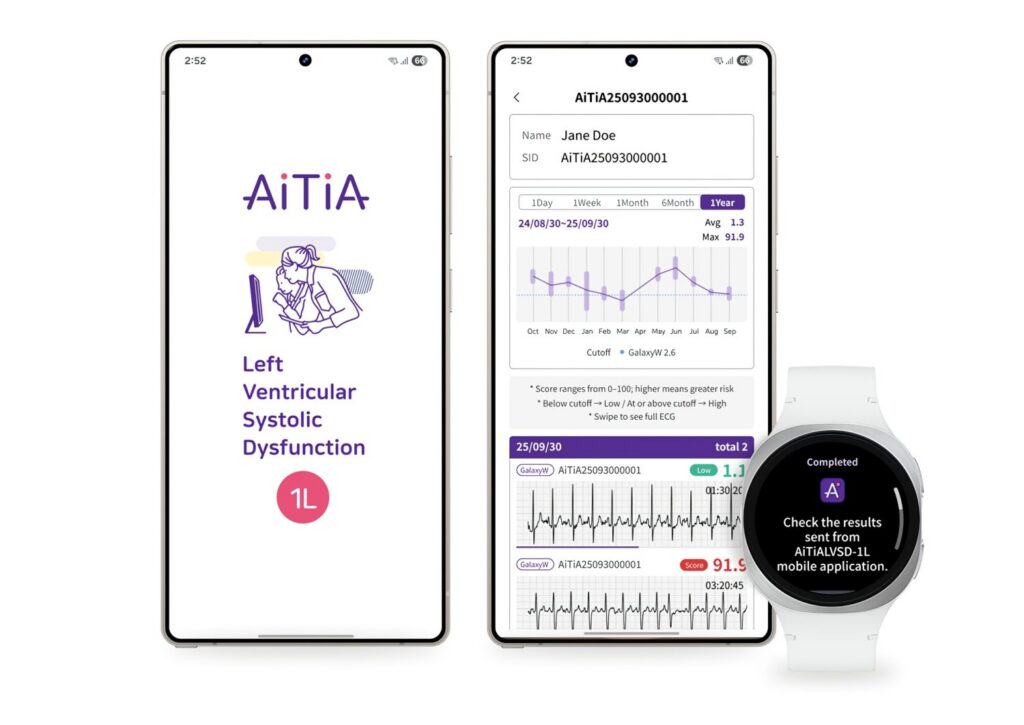 Tu Galaxy Watch podría salvarte la vida: Samsung quiere revolucionar la detección de problemas cardíacos