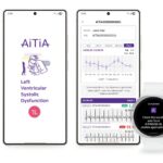 Tu Galaxy Watch podría salvarte la vida: Samsung quiere revolucionar la detección de problemas cardíacos