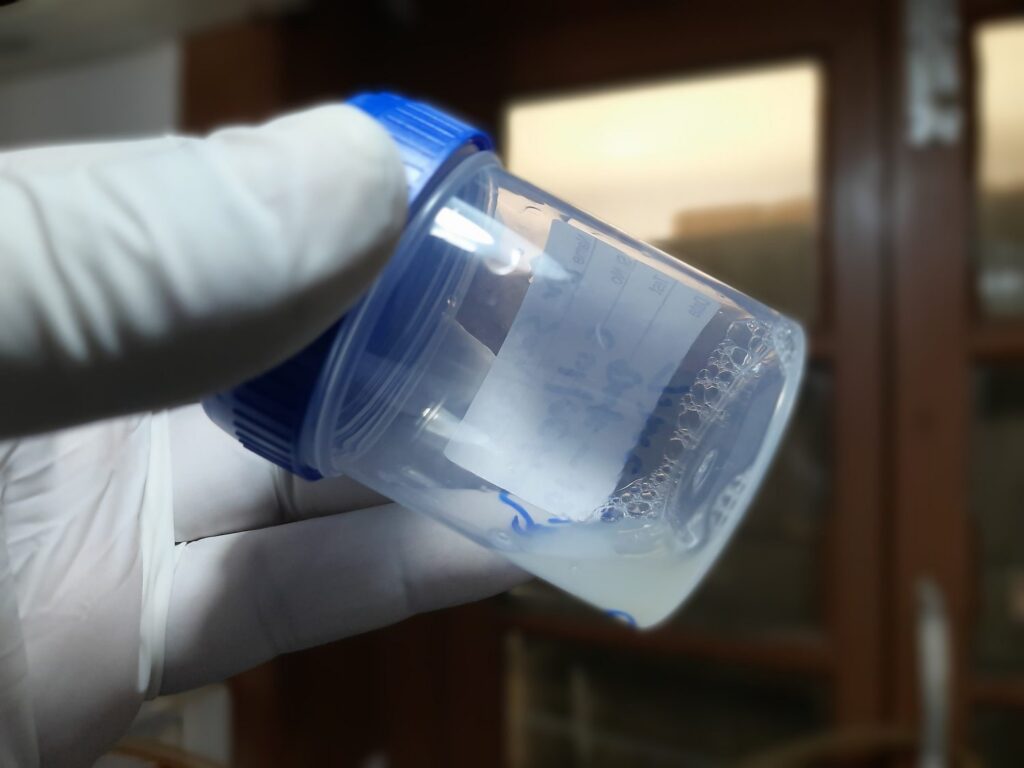 No te lo has imaginado, algunas plantas huelen a semen