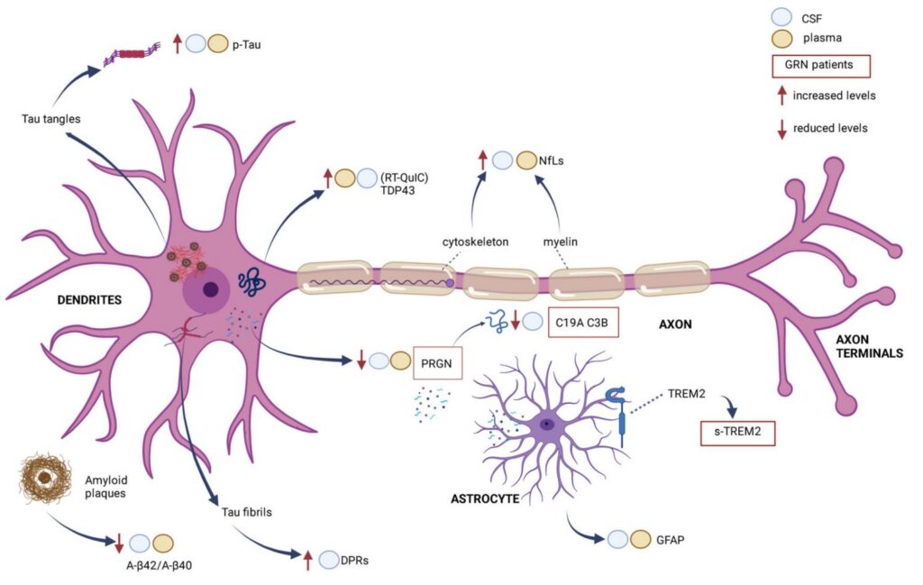 La familia de Bruce Willis toma una decisión difícil: donará un órgano del actor a la ciencia tras su muerte