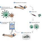 Este tratamiento ha eliminado la enfermedad en un 64 % de pacientes con un cáncer incurable