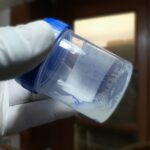 Dona semen a 200 hijos y causa un drama genético: algunos ya han muerto incluso