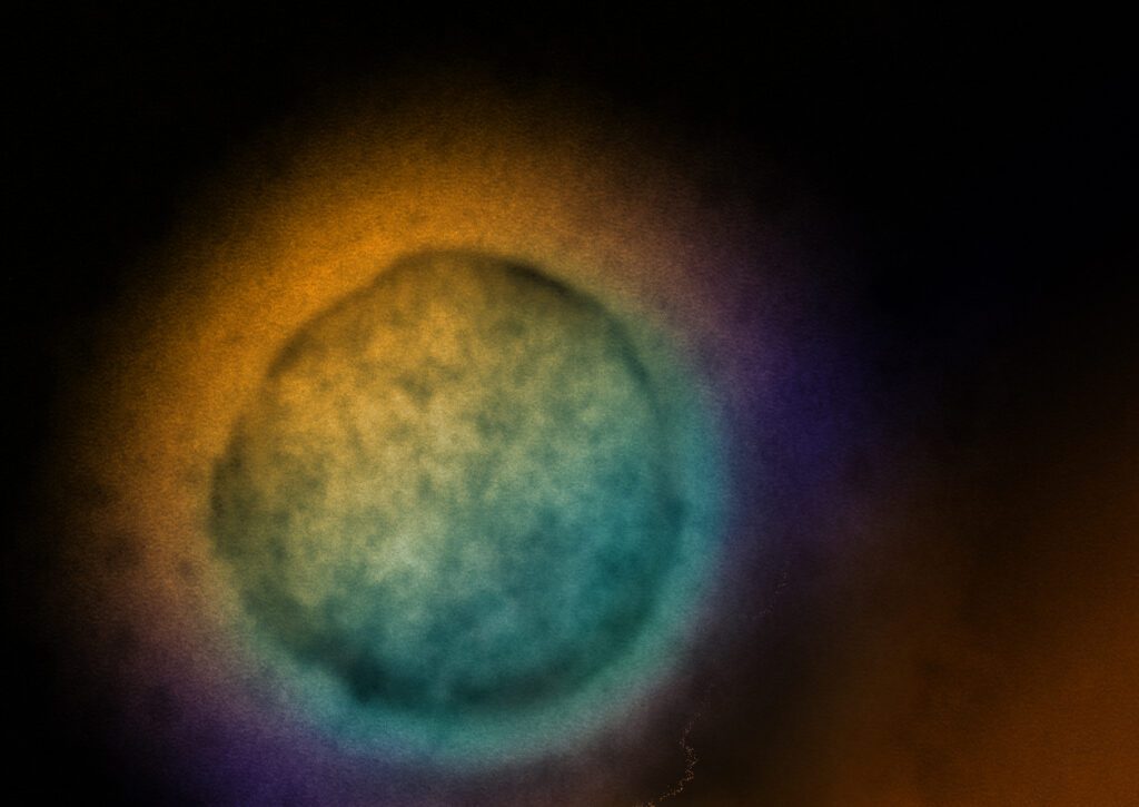 Creían que era Nipah, pero encontraron otro virus saltando de murciélagos a humanos